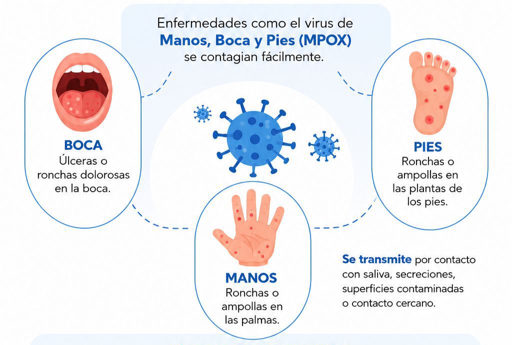 Hospital Santa Isabel reporta siete casos de la enfermedad de manos, pies y boca: autoridades activan vigilancia comunitaria